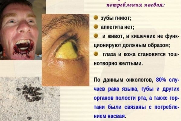 Кракен наркоплощадка